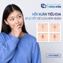 Tác Động Của Thẩm Mỹ Vùng Kín Đến Đời Sống Giường Chiếu Hôn Nhân 